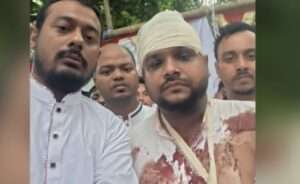 রক্তাক্ত ছবি শেয়ার করে স্বরাষ্ট্রমন্ত্রীর কাছে বিচার চাইলেন পাটওয়ারী