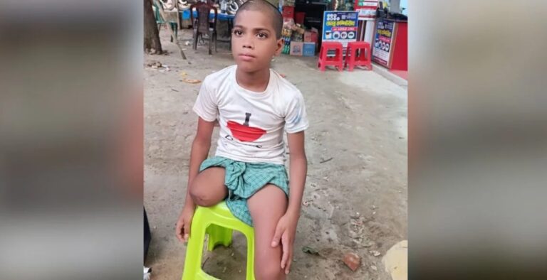 চুল কাটতে বের হওয়া রায়হান ফিরল এক পা ও কিডনি হারিয়ে