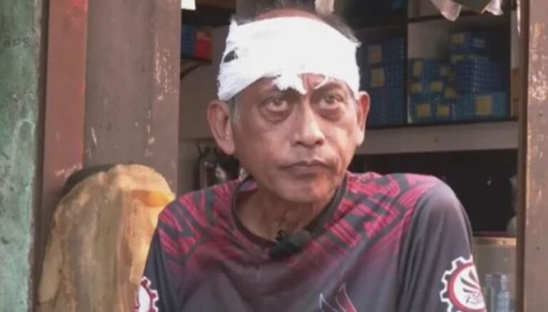 যশোরে অভিনেতা সমু চৌধুরীর মাথা ফাটালেন গ্যারেজ মালিক ও মেকানিক